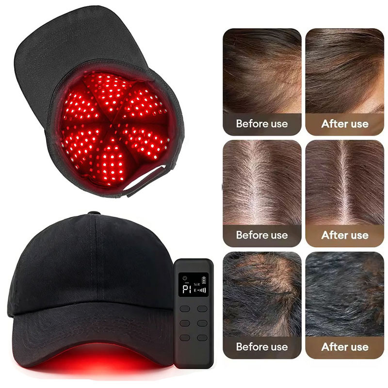 Topi Terapi Cahaya Merah LED 6 - Hair Care Wella ulasan dan harga