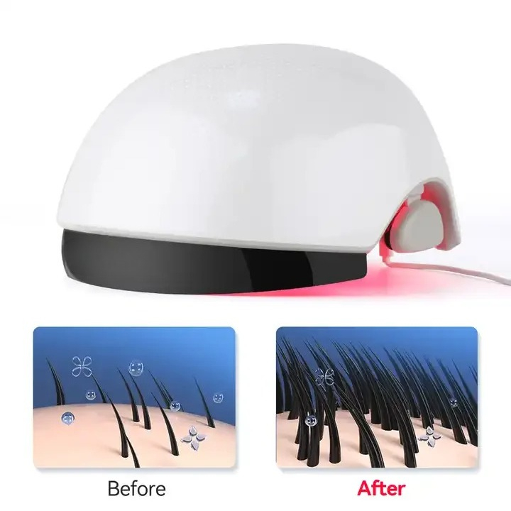 Helm Penumbuh Rambut Cahaya Me - Hair Care Lab ulasan dan harga